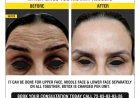BEST BOTOX CLINIC IN CHANDIGARH